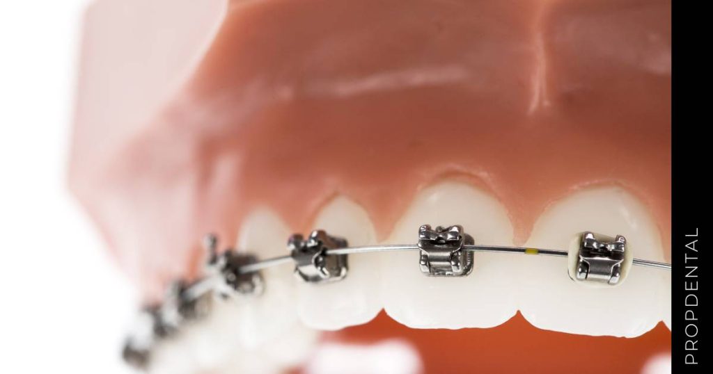 Brackets Metálicos