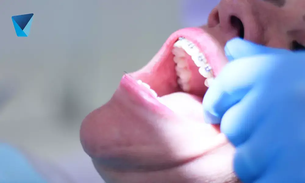 ¿Urgencia dental en Santiago?: atención inmediata