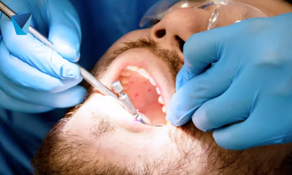 Tratamiento de absceso dental