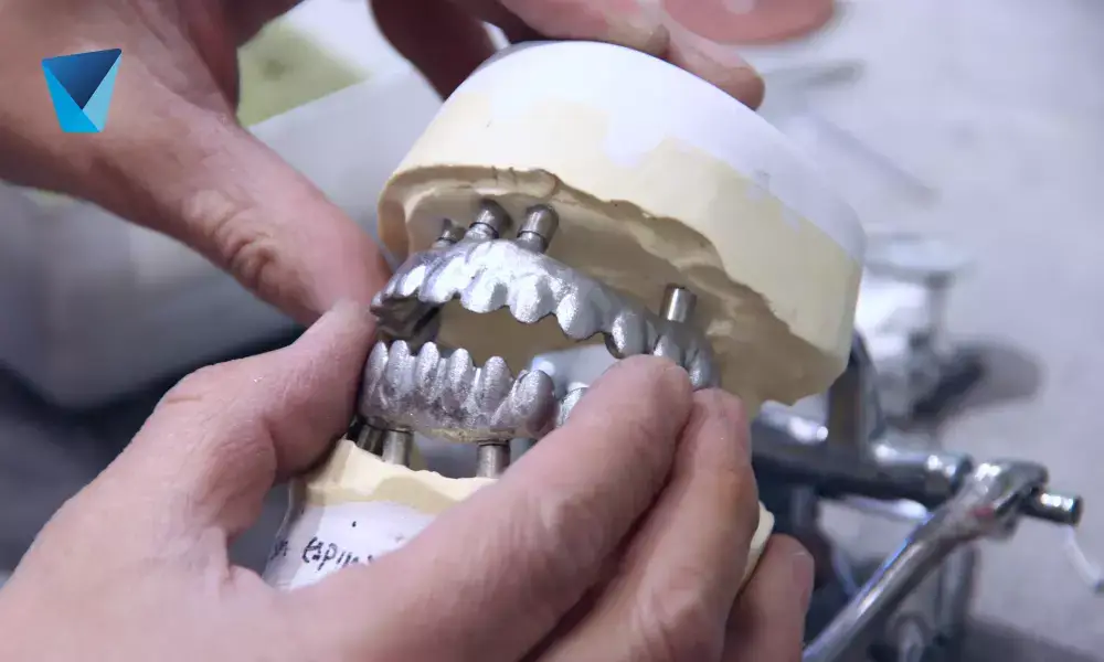 Bancos dentales y otras curiosidades sobre los dientes