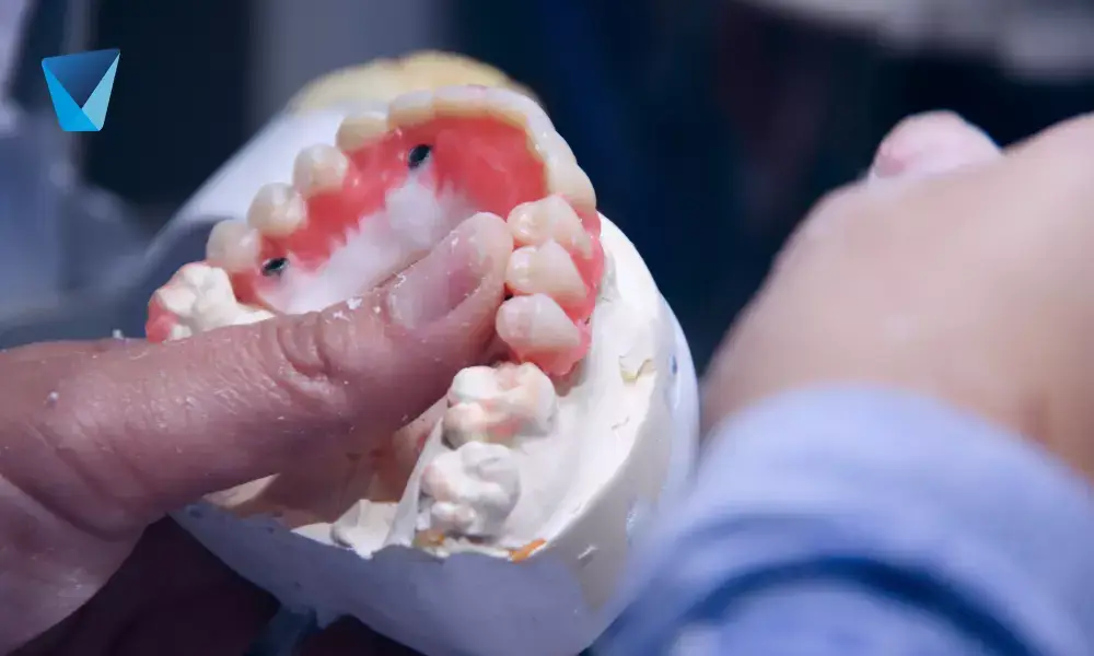 Famosos con prótesis dentales