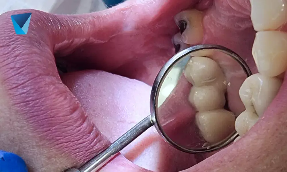 Imagen destacada del artículo: ¡Un mapamundi en la lengua! ¿sabes qué es la lengua geográfica?