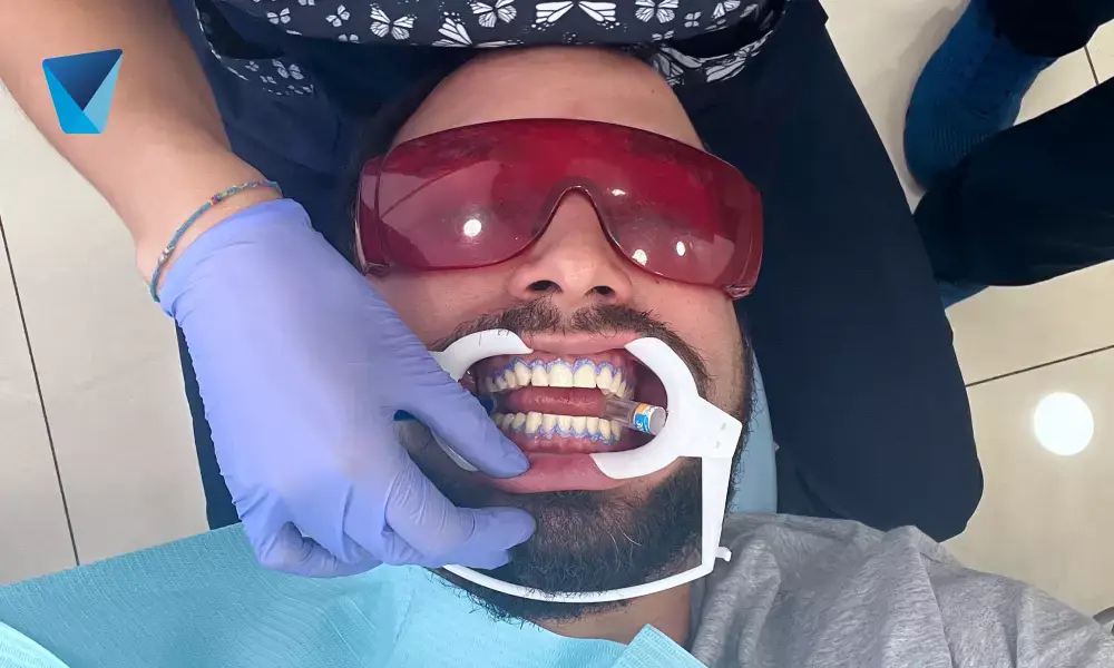 Causas y como evitar sarro dental